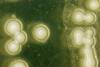 Picture of yeast cells under the microscope