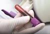 Blood samples in clinical environment