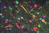 An image of P. gingivalis' gingipains in the neurons of Alzheimer's brain
