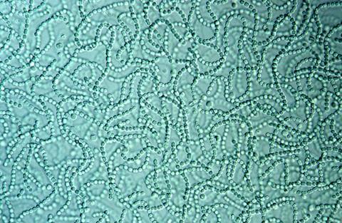 Cyanobacteria in water